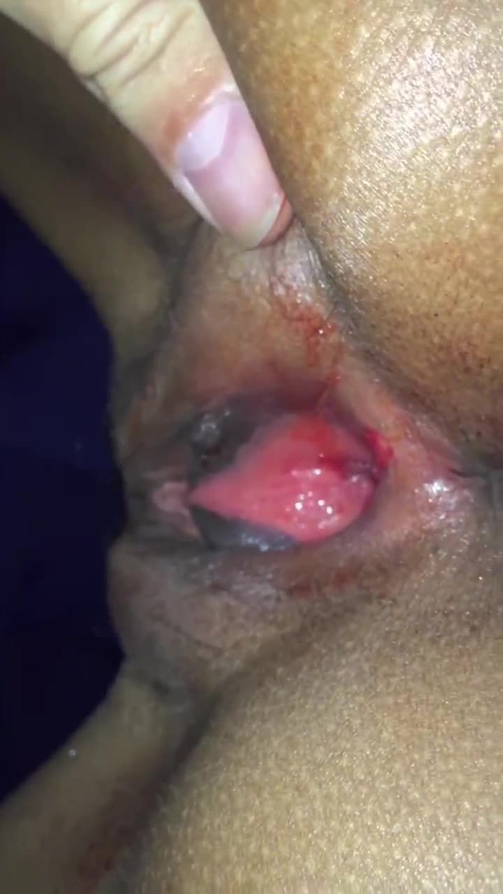 初中生少女被鬼迷心窍兽父戴套破处视频